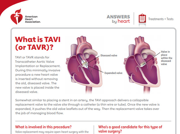 What Is TAVR TAVI EmPOWERED To Serve